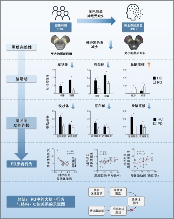 研究发现中脑黑质的结构损伤影响帕金森患者的序列工作记忆