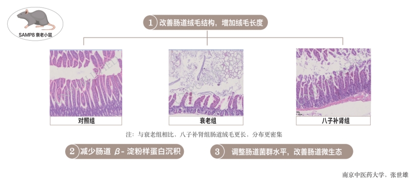 人老肠先衰，八子补肾延缓肠道衰老又添新证据