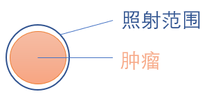 国际肺癌日 | 原来肺癌放疗也可以这么做